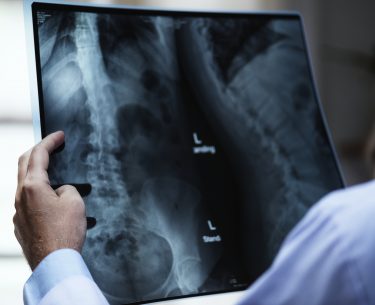 Radiology studies…a vital part of your diagnosis
