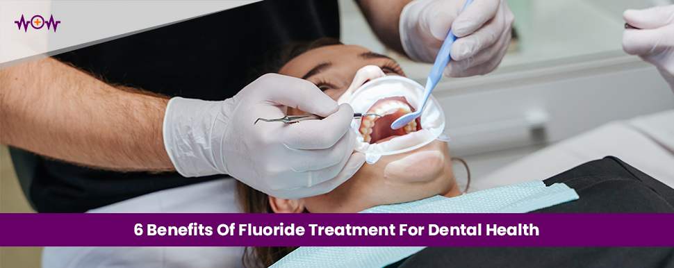  5 Benefits Of Fluoride Treatment For Dental Health