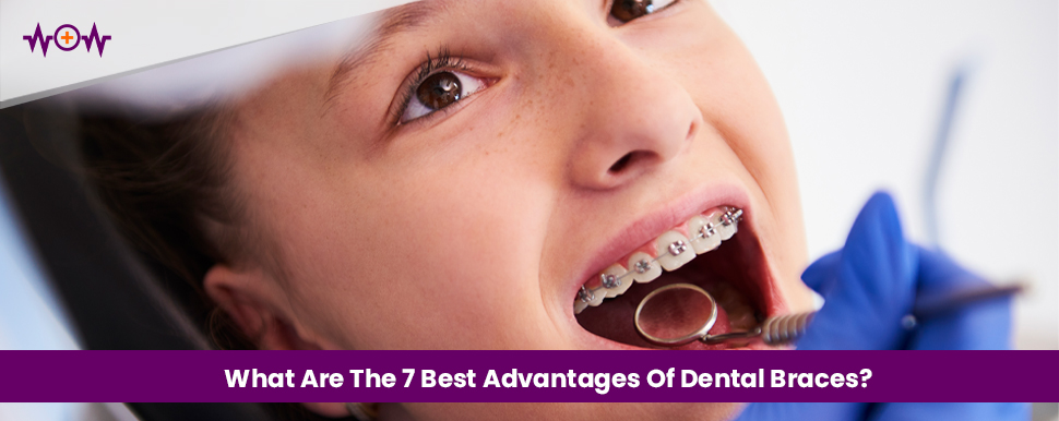 What Are The 7 Best Advantages Of Dental Braces?