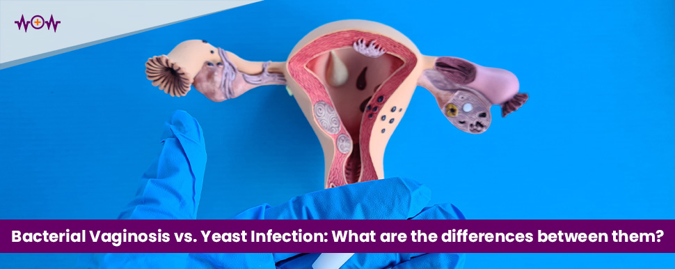 Bacterial Vaginosis vs. Yeast Infection: What are the differences between them?