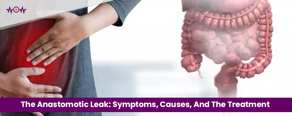 the-anastomotic-leak-symptoms-causes-and-the-treatment