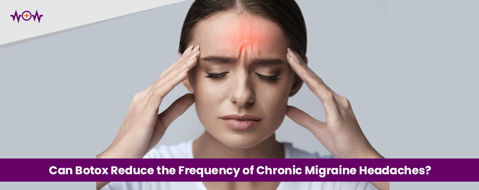 Can Botox Reduce the Frequency of Chronic Migraine Headaches?