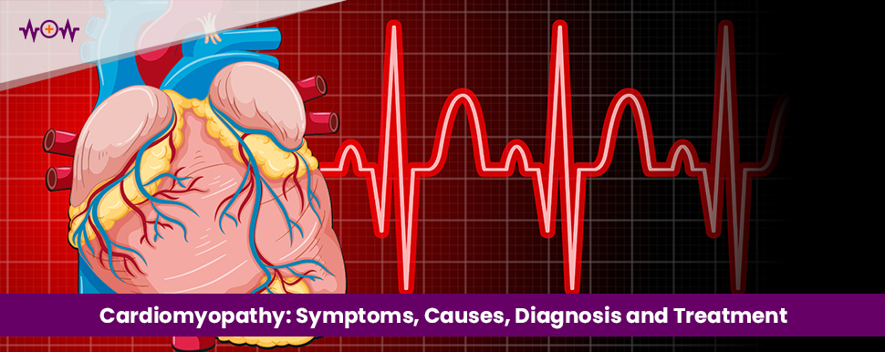 Cardiomyopathy: Symptoms, Causes, Diagnosis and Treatment