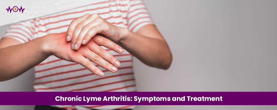 Chronic Lyme Arthritis: Symptoms and Treatment