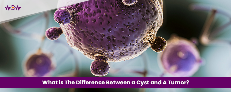 what-is-the-difference-between-a-cyst-and-a-tumor
