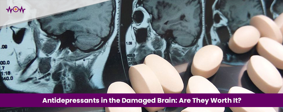 antidepressants-in-the-damaged-brain-are-they-worth-it