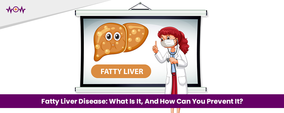Fatty Liver Disease: What Is It, And How Can You Prevent It?