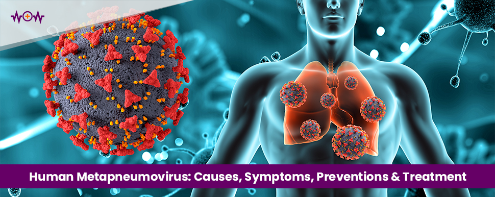 Human Metapneumovirus: Causes, Symptoms, Preventions & Treatment