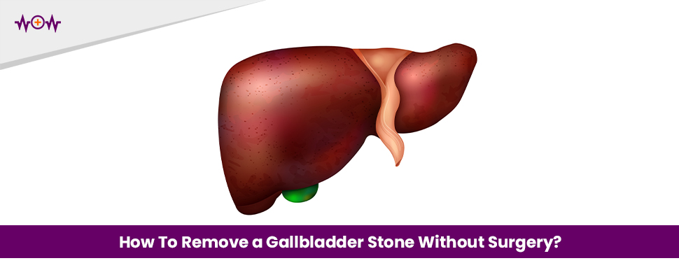How To Remove a Gallbladder Stone Without Surgery?