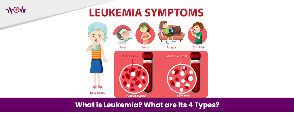 What is Leukemia? What are its 4 Types?
