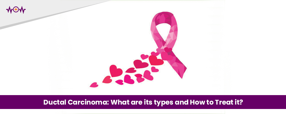 Ductal Carcinoma: What are its types and How to Treat it?