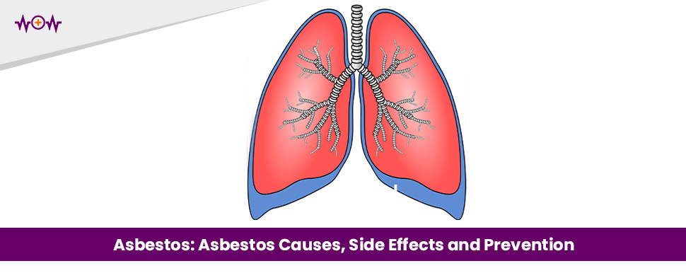 Asbestos: Asbestos Causes, Side Effects and Prevention