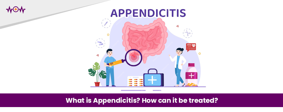 What is Appendicitis? How can it be treated?