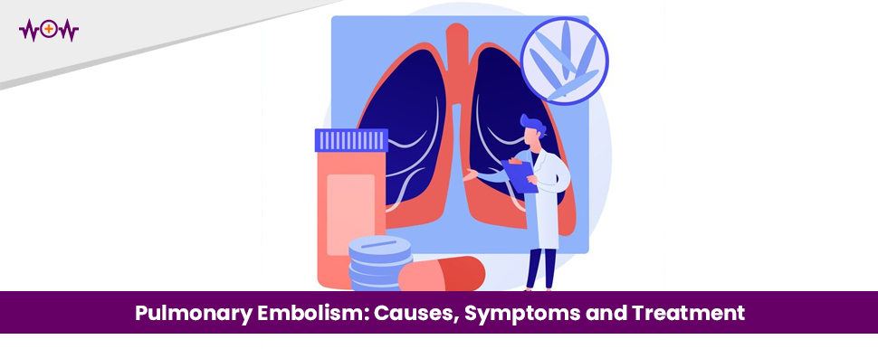 Pulmonary Embolism: Causes, Symptoms and Treatment