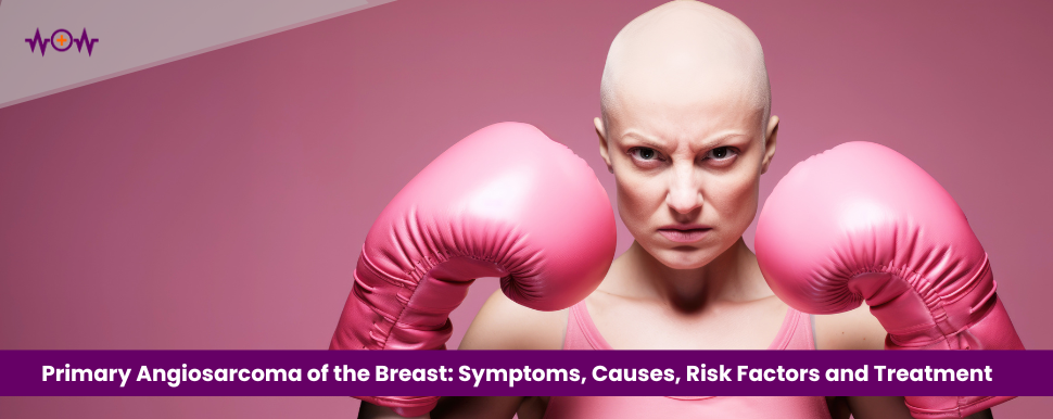 Primary Angiosarcoma of the Breast: Symptoms, Causes, Risk Factors and Treatment