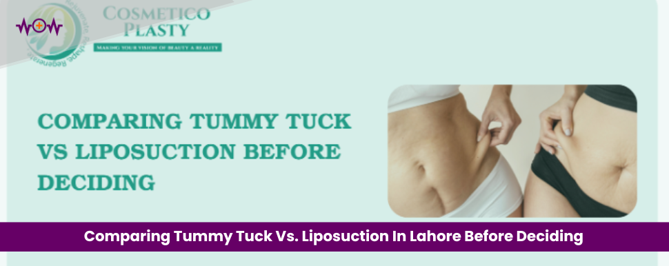 Comparing Tummy Tuck Vs. Liposuction Before Deciding