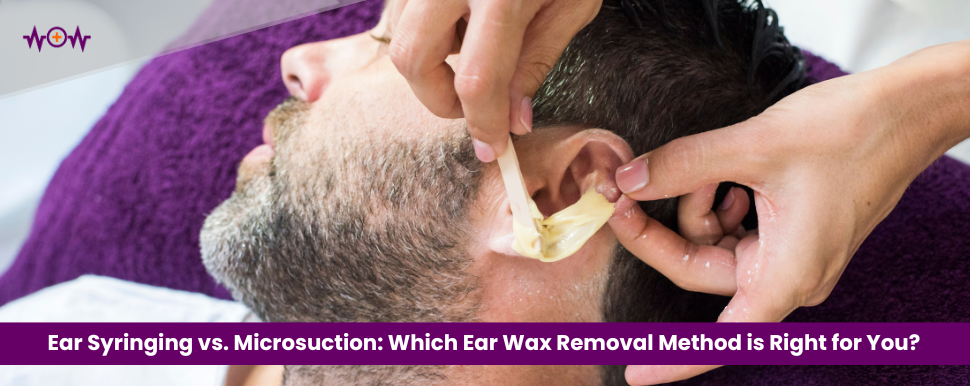 Ear Syringing vs. Microsuction: Which Ear Wax Removal Method is Right for You?