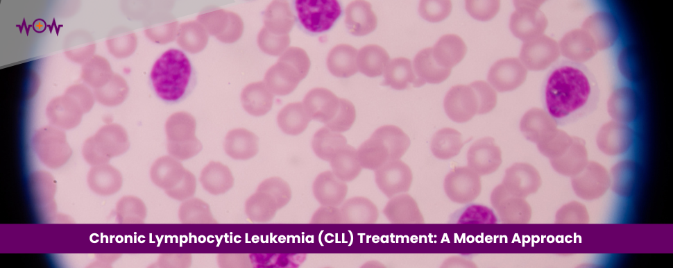 Chronic Lymphocytic Leukemia (CLL) Treatment: A Modern Approach