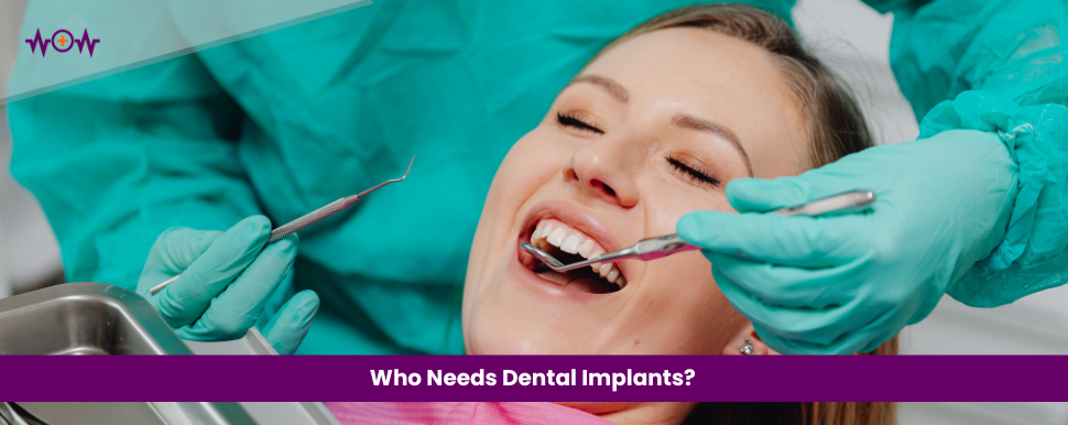Who Needs Dental Implants?