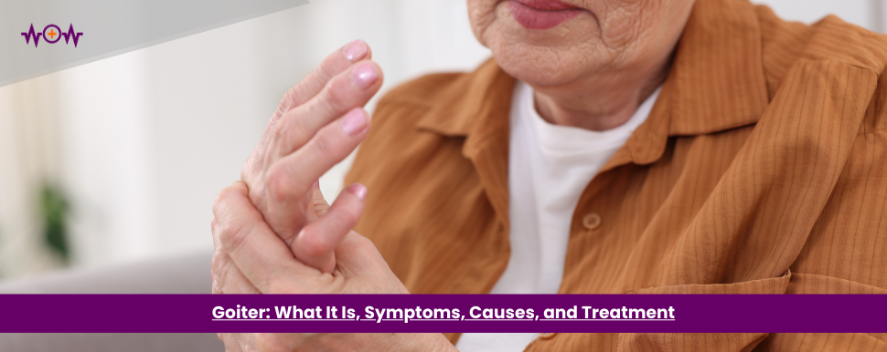 Goiter: What It Is, Symptoms, Causes, and Treatment