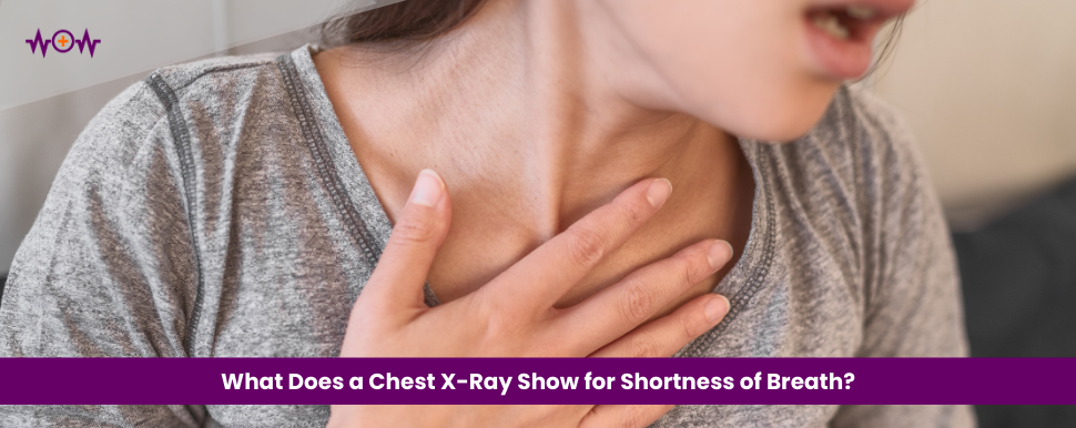 What Does a Chest X-Ray Show for Shortness of Breath?