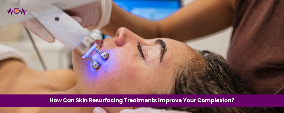 How Can Skin Resurfacing Treatments Improve Your Complexion?
