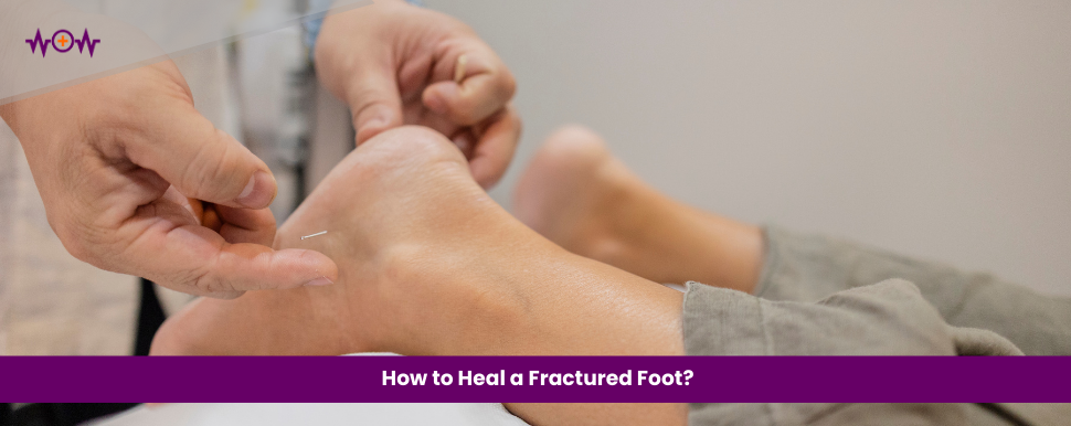 How to Heal a Fractured Foot?