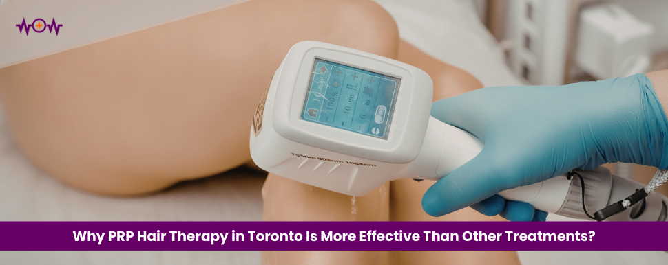 Why PRP Hair Therapy in Toronto Is More Effective Than Other Treatments?