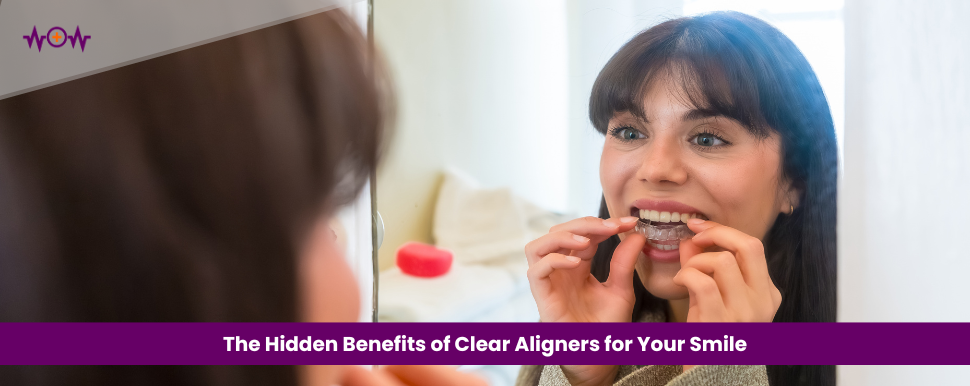 The Hidden Benefits of Clear Aligners for Your Smile