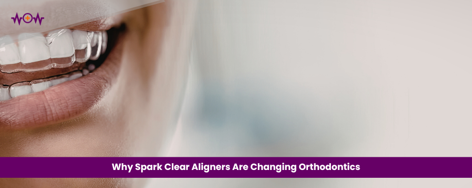 Why Spark Clear Aligners Are Changing Orthodontics