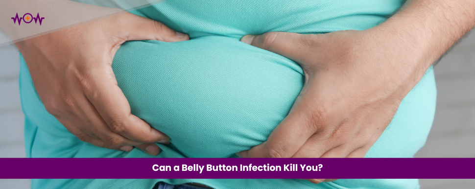 Can a Belly Button Infection Kill You?