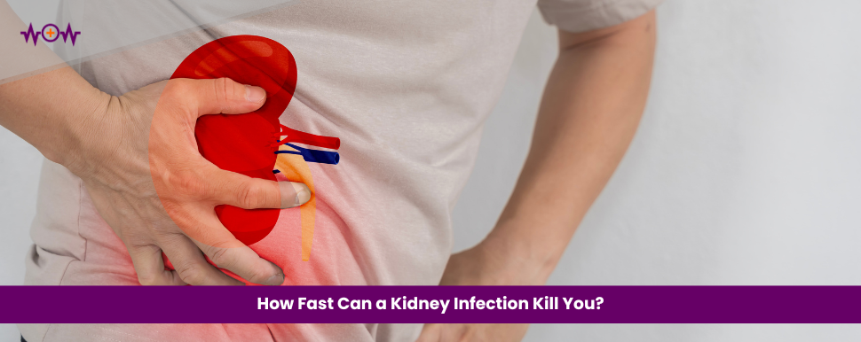 How Fast Can a Kidney Infection Kill You?