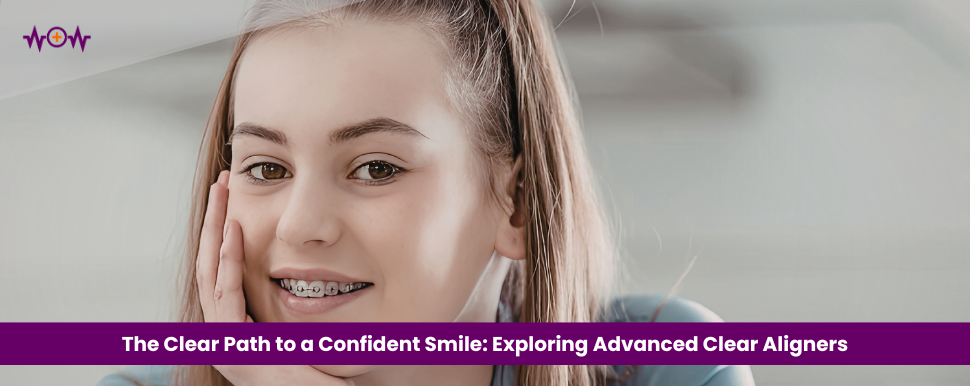 The Clear Path to a Confident Smile: Exploring Advanced Clear Aligners