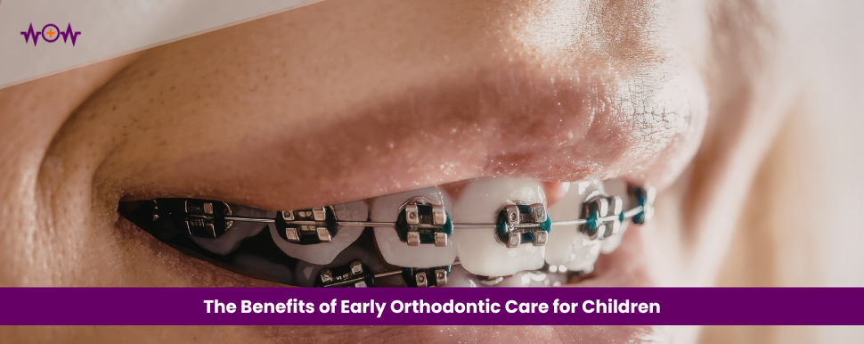 The Benefits of Early Orthodontic Care for Children